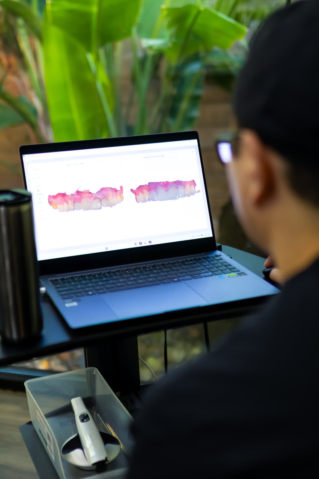 Reviewing a digital 3D scan of a patient's teeth